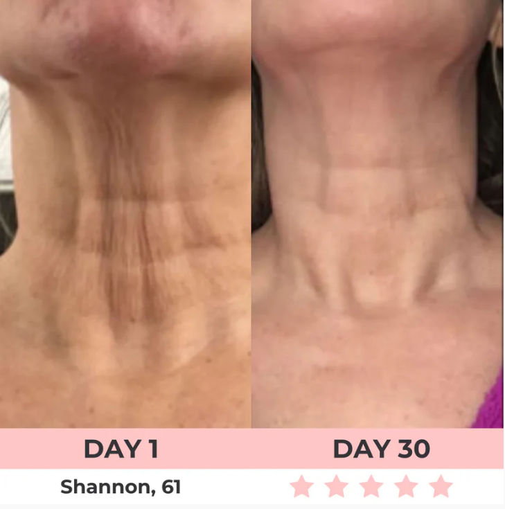 LUMEVIA 7-in-1 LED Facial Sculptor